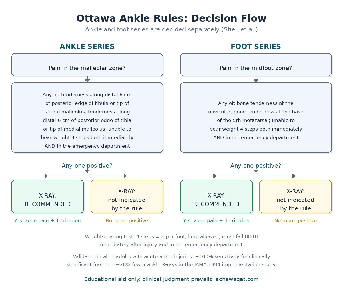 Ottawa ankle rules calculator decision flow: malleolar zone pain leads to three ankle criteria and foot midfoot pain leads to three foot criteria, each ending in X-ray recommended or not indicated