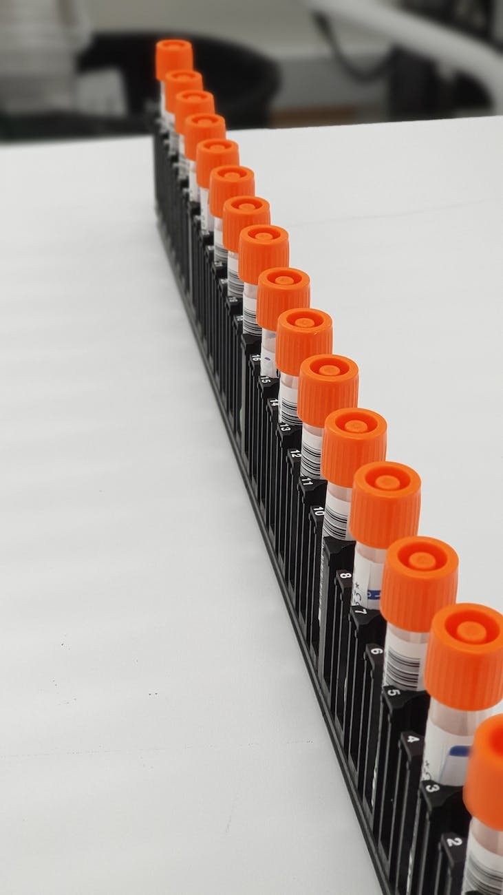 blood samples in test tubes in a row