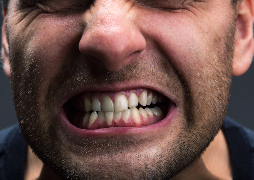 Read more about the article Are You a Victim of Teeth Grinding? Causes, Consequences, and Coping Strategies